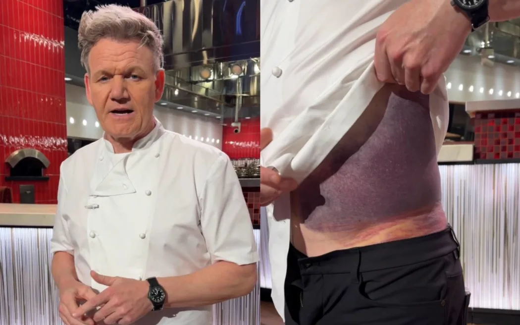 Gordon Ramsay says wearing a helmet saved his life during a bike accident in Connecticut earlier this week